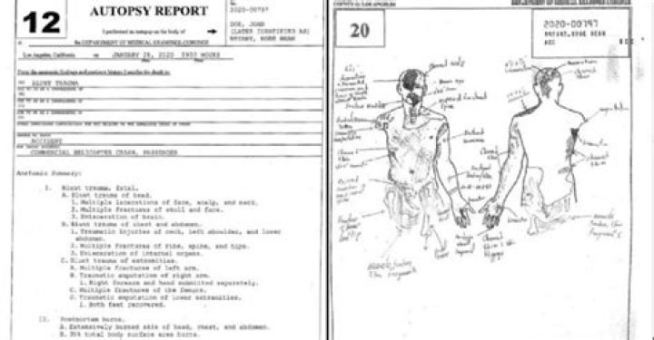 Kobe and Gianna Bryant’s autopsy report released REVOLT